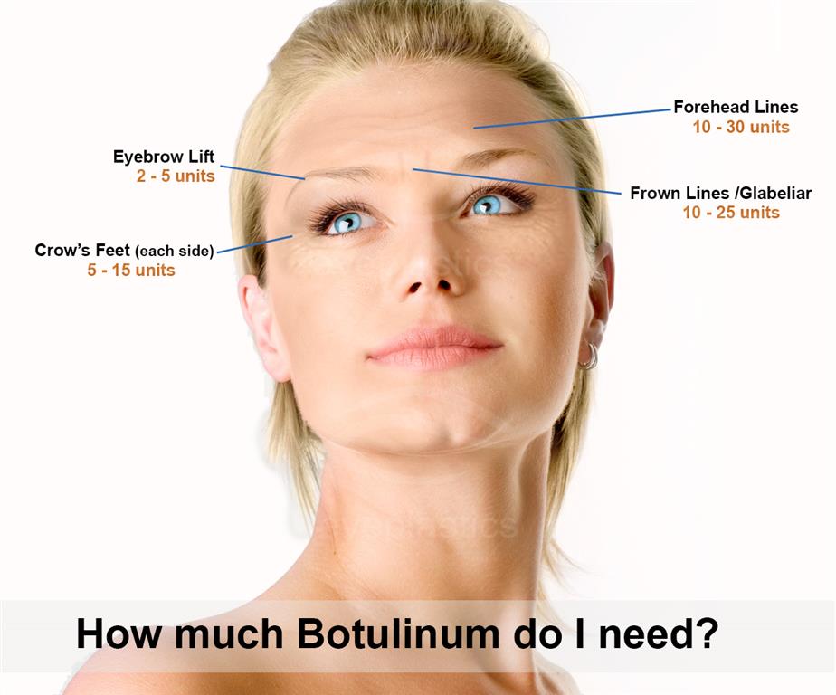 Allergan Botox 